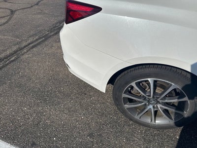 2015 Acura TLX V6