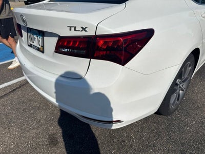 2015 Acura TLX V6