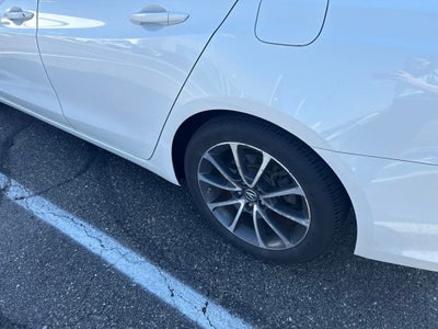 2015 Acura TLX V6