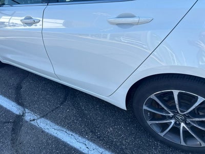2015 Acura TLX V6